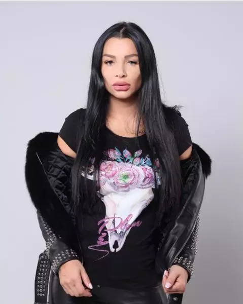 Brigitte-operatii-estetice1