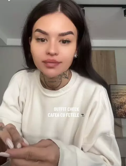 Diandra de la Insula iubirii, o nouă intervenție estetică  (2)