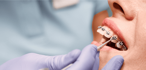 Care sunt cele mai frecvente probleme dentare la adolescenți?