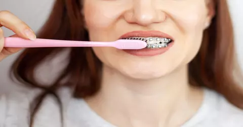 Cum se îngrijește aparatul dentar: Reguli de igienă