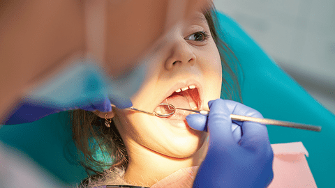 Alimente care ne ajută să avem dinți sănătoși vs alimente care dăunează sănătății dentare