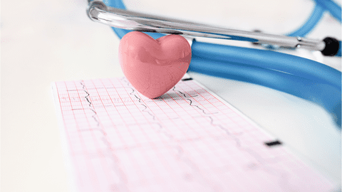 Electrocardiograma și riscul cardiovascular - o abordare esențială în prevenirea bolilor de inimă