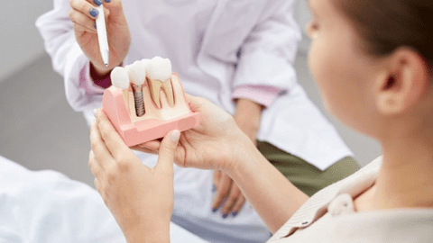 Implant dentar după 40 sau 50 de ani: când este posibil și ce trebuie evaluat înainte