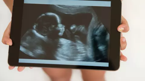 Pozitionarea copilului inainte de nastere