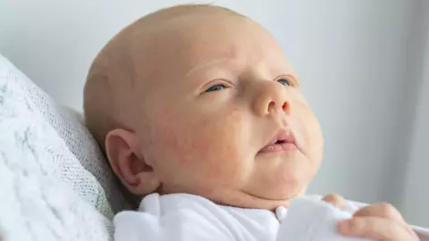 Bolile atopice in copilarie