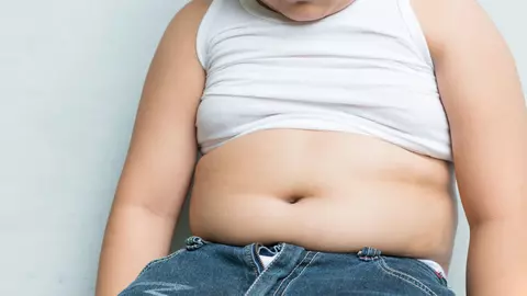 Obezitatea la copii