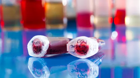 Celulele stem, dincolo de poveste