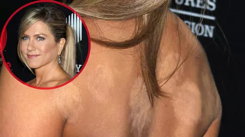 Jennifer Aniston apelează la terapia cu ventuze pentru a rămâne însărcinată