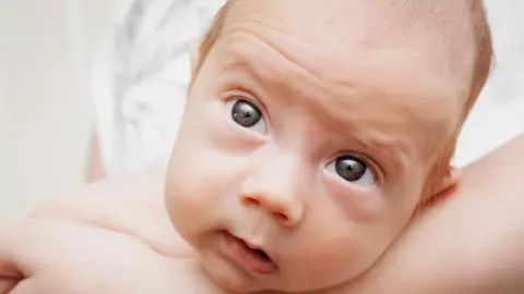 Glaucom la bebeluși - cum îl depistezi din timp