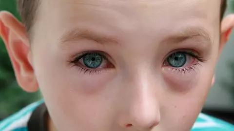 Are ochii roșii - de ce?