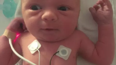 Medicii i-au sfătuit pe părinți să-și lase bebelușul să se stingă în pace, însă un miracol s-a întâmplat