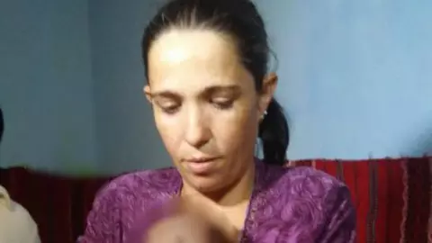 O mămică din Gorj acuză medicii de malpraxis, după ce fetița ei s-a născut cu fractură de claviculă și răni la ochi | VIDEO