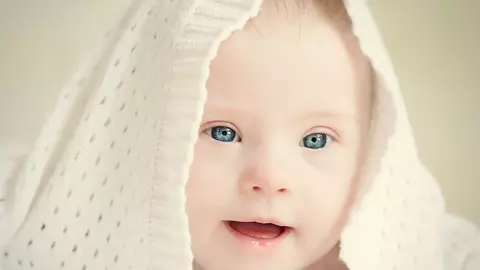 Sindromul Down: Tot ce trebuie sa stii despre el