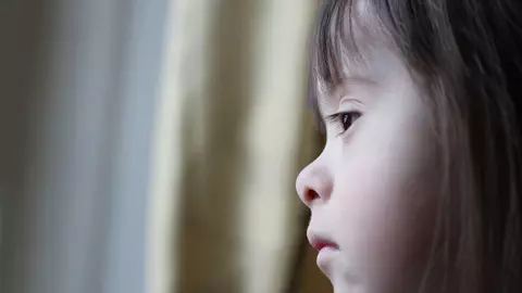 Islanda, pe cale sa eradicheze Sindromul Down, folosind metode controversate