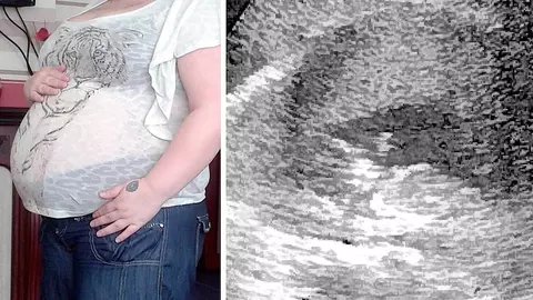 S-a dus la ecografie sa-si vada copilul, insa nu i se vedea decat capul. Motivul a marcat-o pe viata