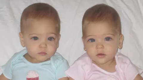 Au 7 ani si sunt considerate cele mai frumoase gemene din lume. Cum arata acum - FOTO