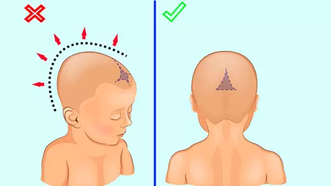7 semne subtile, care ar trebui sa te trimita direct la medic