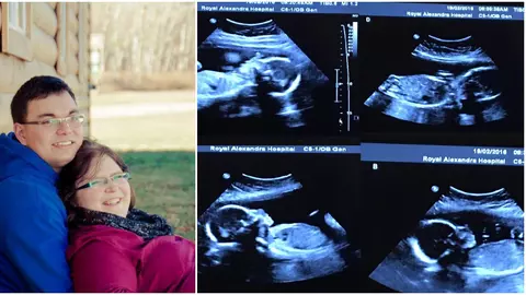 Au avut un soc cand, la ecografie, au aflat ca vor avea 4 gemeni identici