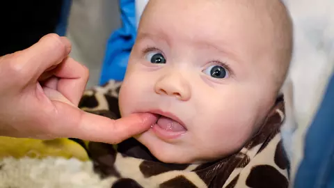 Cum recunosti buza legata sau limba legata la bebelusi