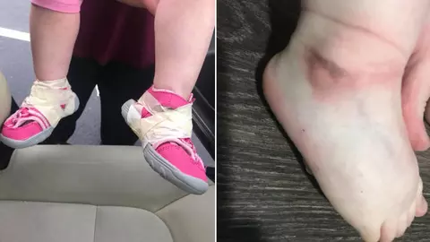 Pentru ca isi tot scotea sandalutele, ingrijitoarele i le-au lipit strans cu scotch