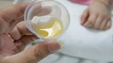 Ce este colostrul si de ce e important in alaptarea nou-nascutului