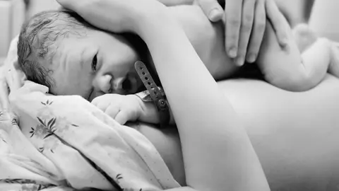 Cum poti preveni epiziotomia la nastere. Cand e necesara procedura