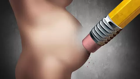 Intreruperea de sarcina: Metode, conditii si intervale limita