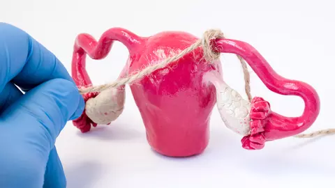 Ligaturarea trompelor uterine: avantaje si dezavantaje