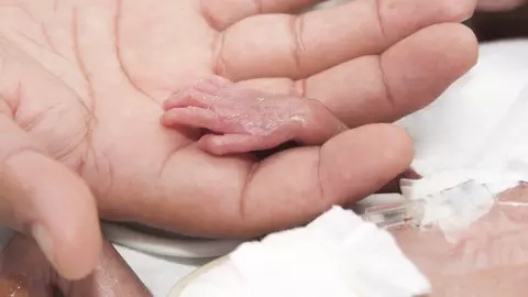 Copilul miracol: cum arata azi cel mai mic prematur din lume