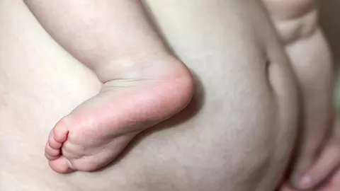 Legarea burtii dupa nastere - Merita sa porti centura postnatala?