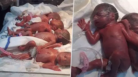 Nastere miraculoasa: Septupleti veniti pe lume pe cale naturala