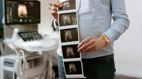 Importanța ecografiilor de morfologie fetală: Ce trebuie să știi despre acestea?