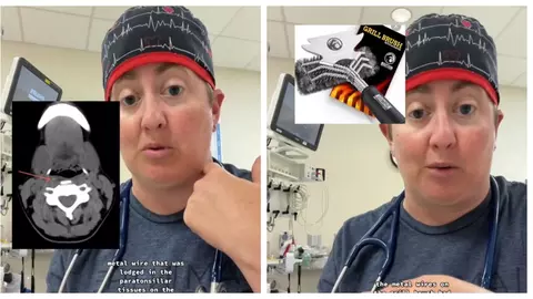 Un copil a ajuns la spital după ce a mâncat un hamburger. Ce au descoperit medicii în gâtul copilului