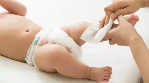 Cum să preveniți problemele pielii alegând șervețelele umede potrivite pentru bebeluși