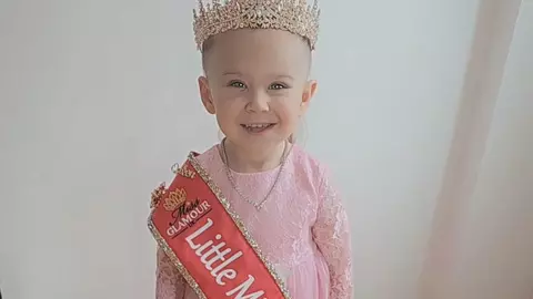 O fetiță care a supraviețuit atacului unui câine a câștigat un concurs de frumusețe. "Cicatricile mele mă fac frumoasă!”