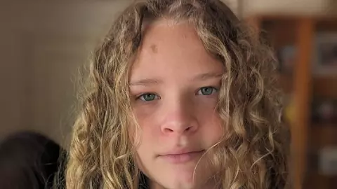 Un adolescent a intrat în stop cardiac după ce a acceptat o provocare la modă pe rețelele sociale