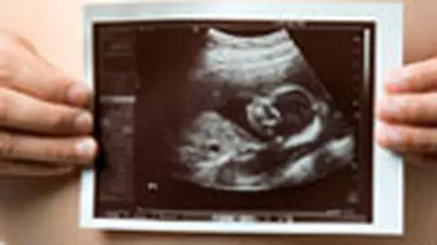 Taina vietii de dinainte de viata