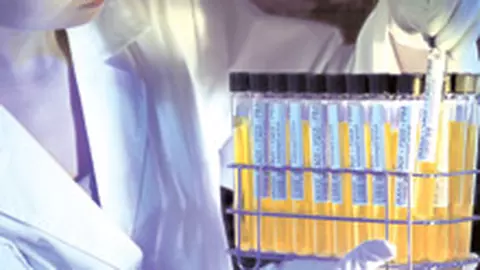 Toxoplasmoza - infectie parazitara