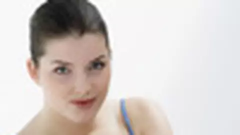 Vergeturile, doar o problema estetica?