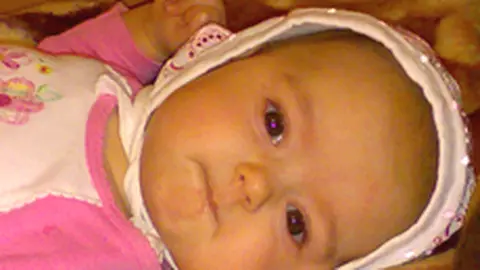 Probleme cu ochisorii