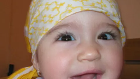 Iritatie in zona scutecului