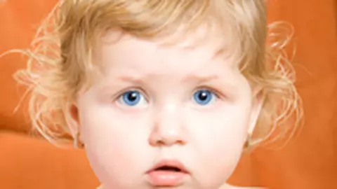 Remediu pentru piele foarte uscata