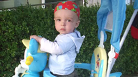 Am trecut cu bine peste malformatia din nastere