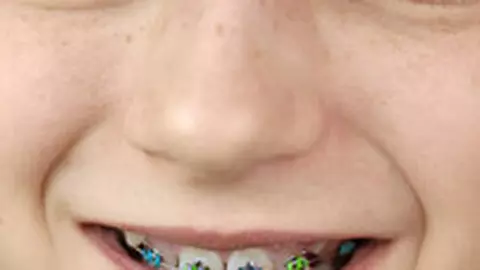 In vacanta... la dentist
