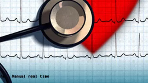 Bolile cardiovasculare