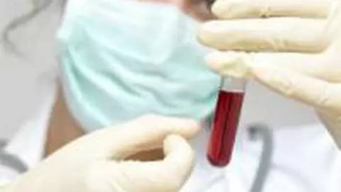 Plan pentru bolnavii de Hepatita C