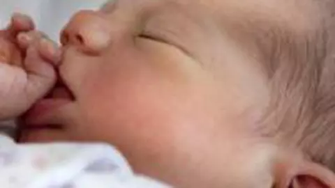 Aspectul fizic al nou-nascutului - 10 raspunsuri simple la intrebari complicate