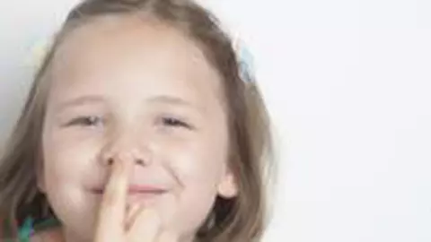 Rinoplastie-Ce trebuie să cunoşti înainte de operaţie!