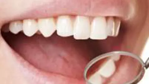 Avantajele şi dezavantajele implanturilor dentare