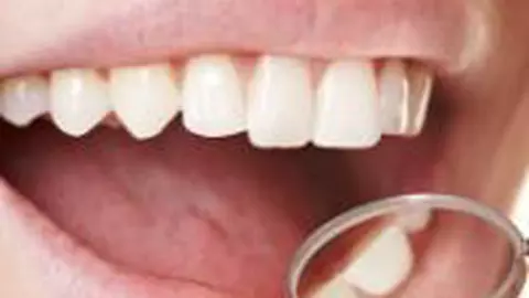 Cum ne afectează alimentaţia dantura?
